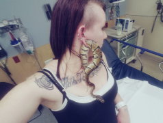 Ashley in emergency room with snake